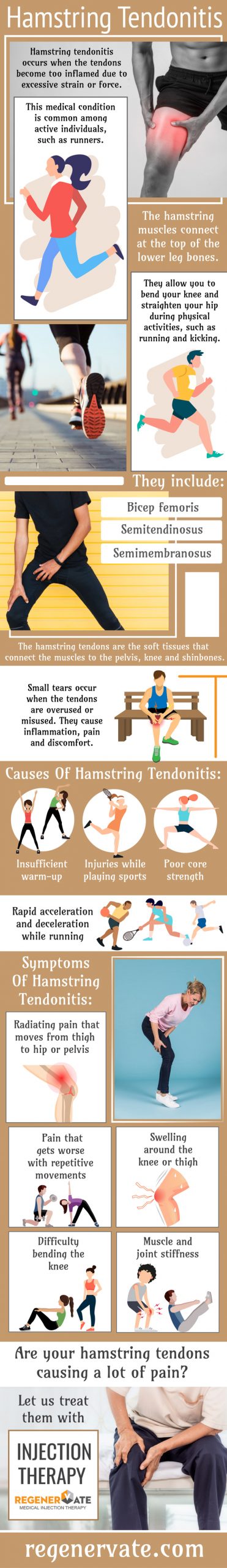 Hamstring Tendonitis: Causes, Symptoms & Treatment